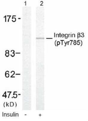 Western Blot: Integrin beta 3/CD61 [p Tyr785] Antibody [NB100-81995]